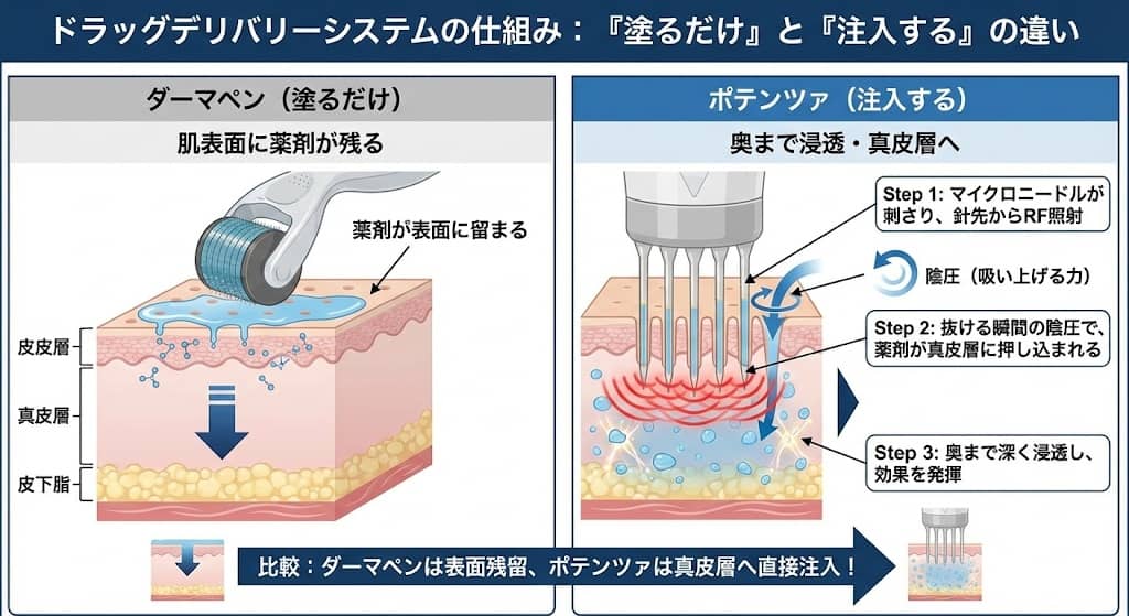 ドラッグデリバリーシステムの仕組み