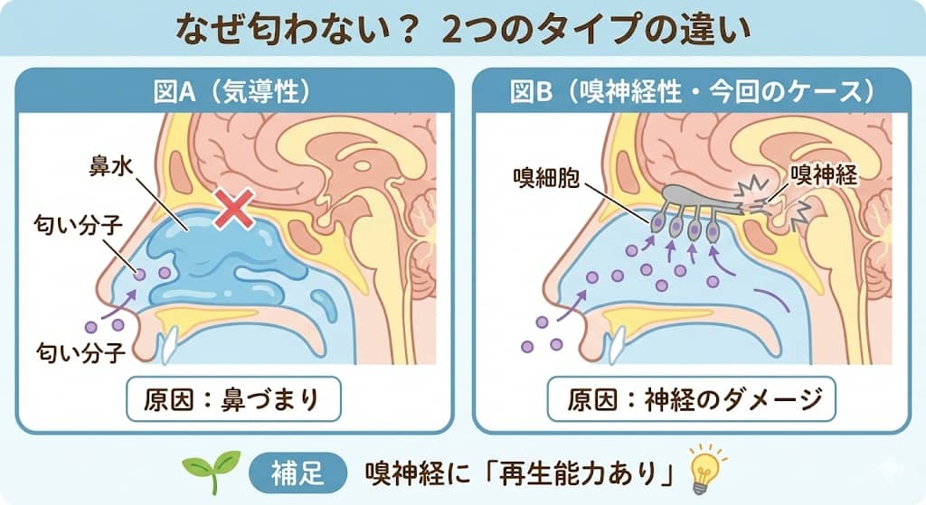 気導性と嗅神経性の違い