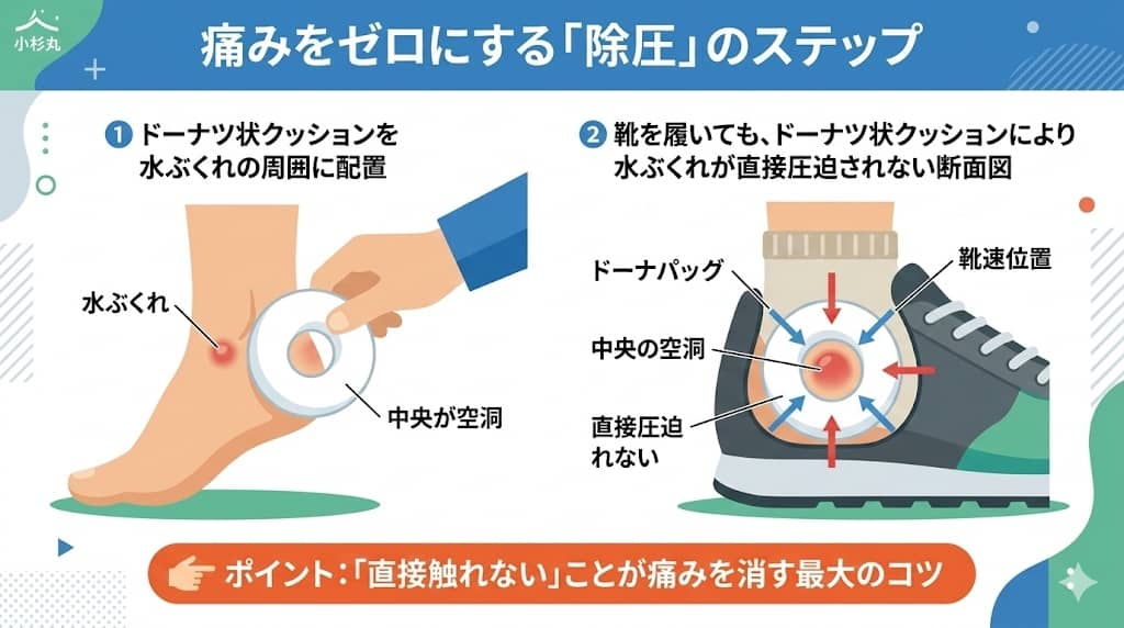ドーナツパッドによる「除圧」の仕組み