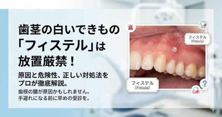 歯茎の白いできもの「フィステル」は放置厳禁！