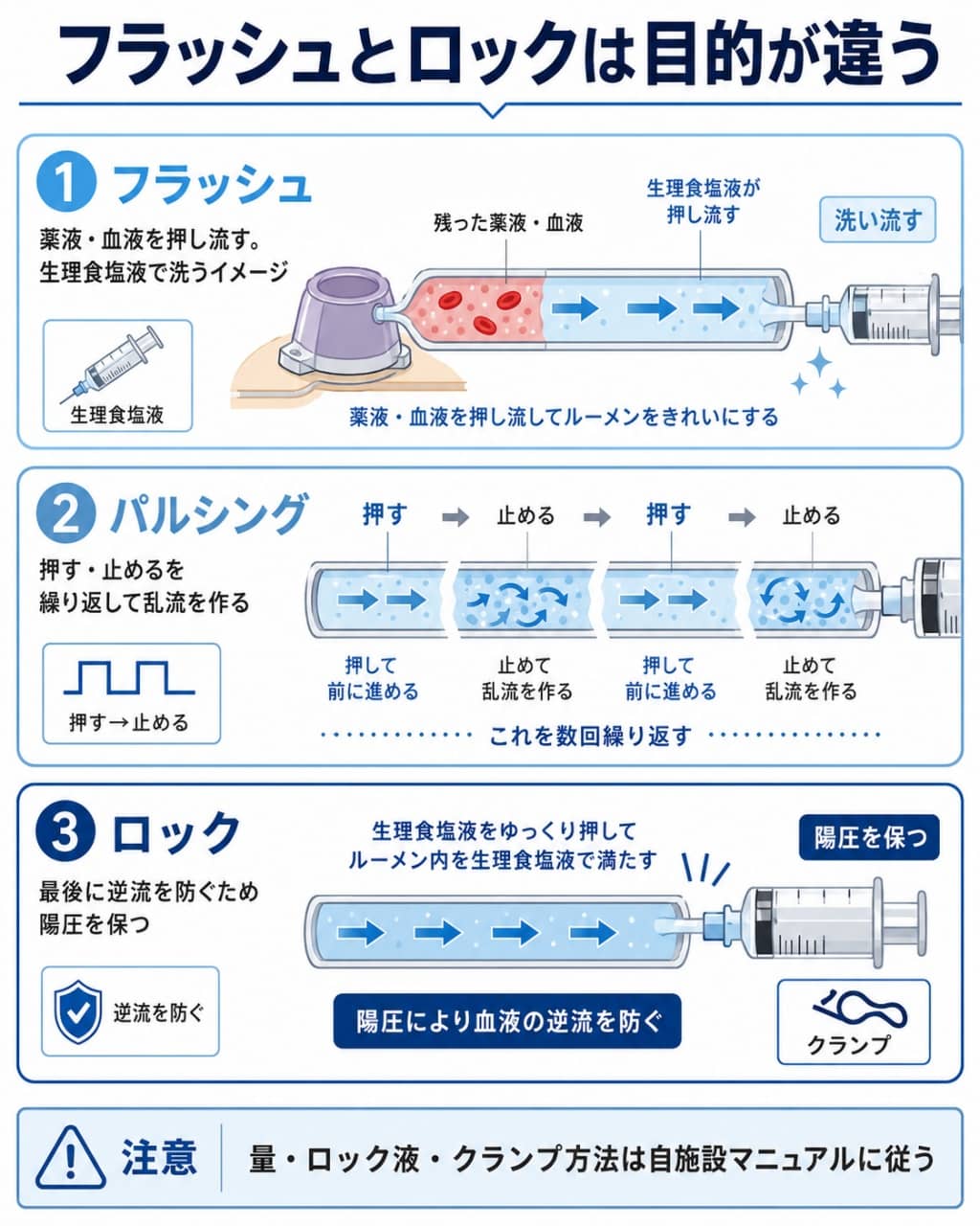 CVポートのフラッシュ・ロックの基本図解