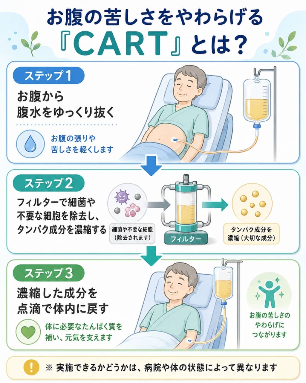 CART（腹水濾過濃縮再静注法）の仕組み図解