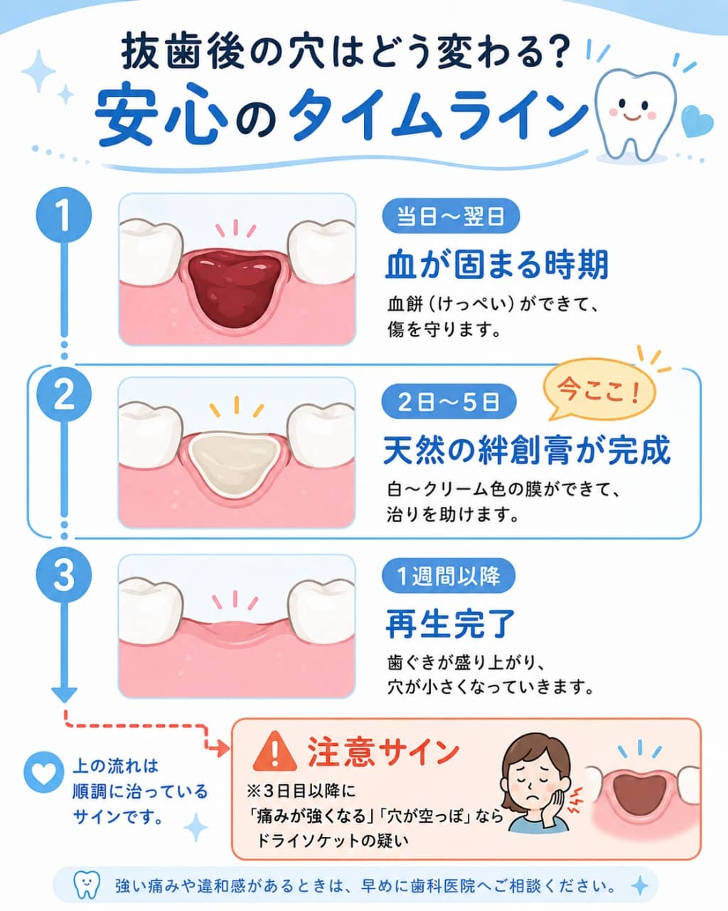 抜歯後の治癒プロセスとドライソケットの分岐点