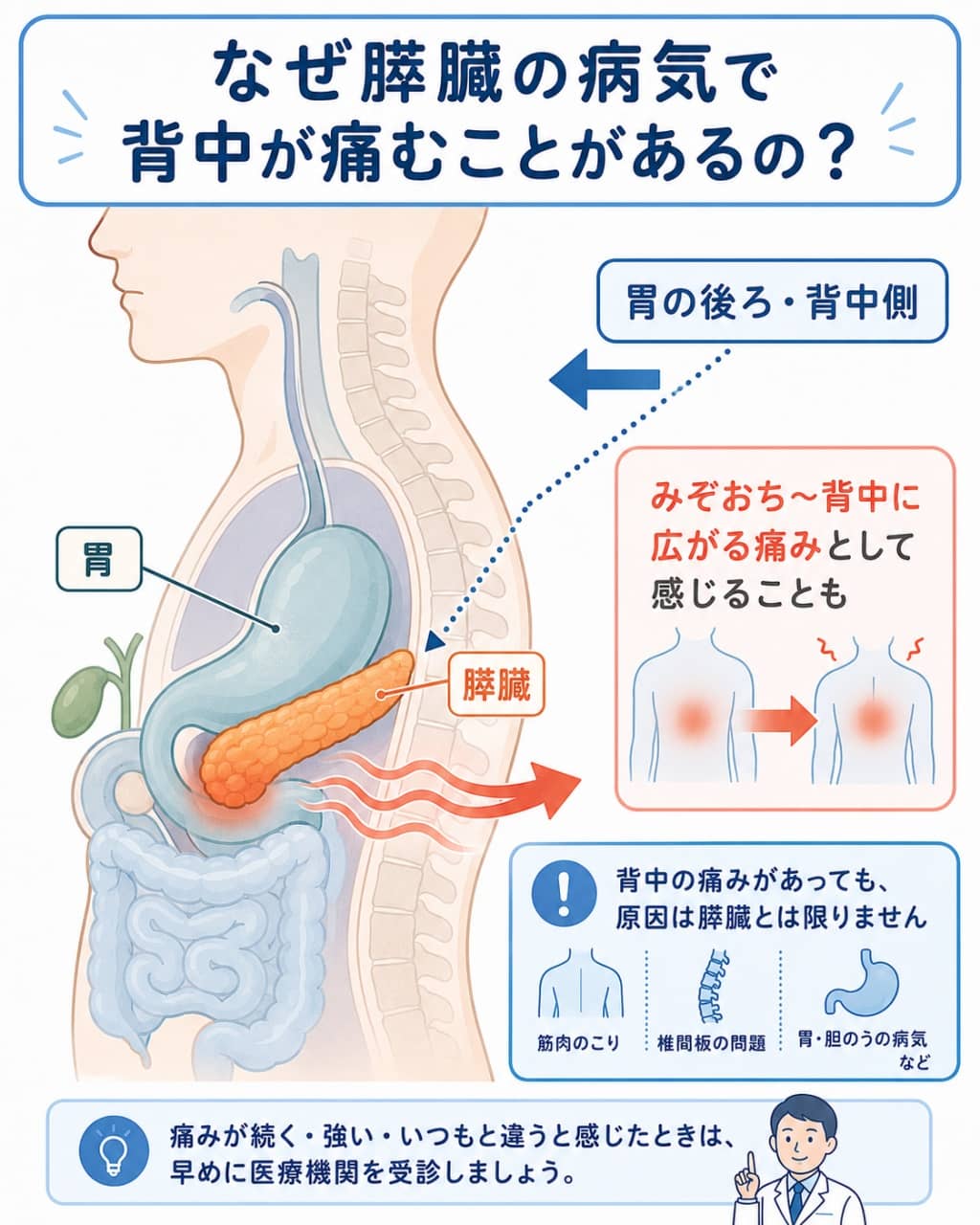 膵臓の位置と背中の痛みのイメージ図
