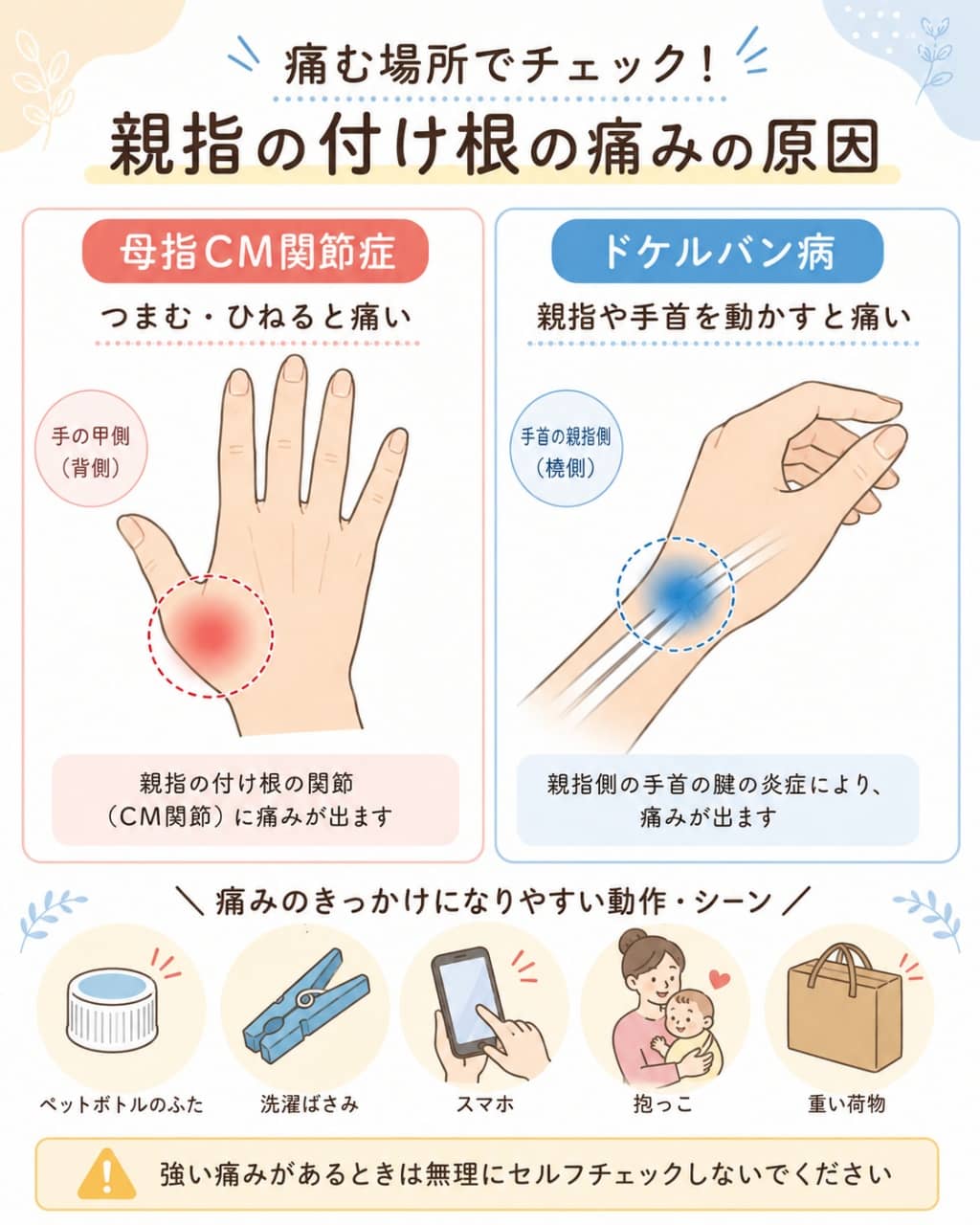 親指の付け根の痛み「母指CM関節症」と「ドケルバン病」の違い